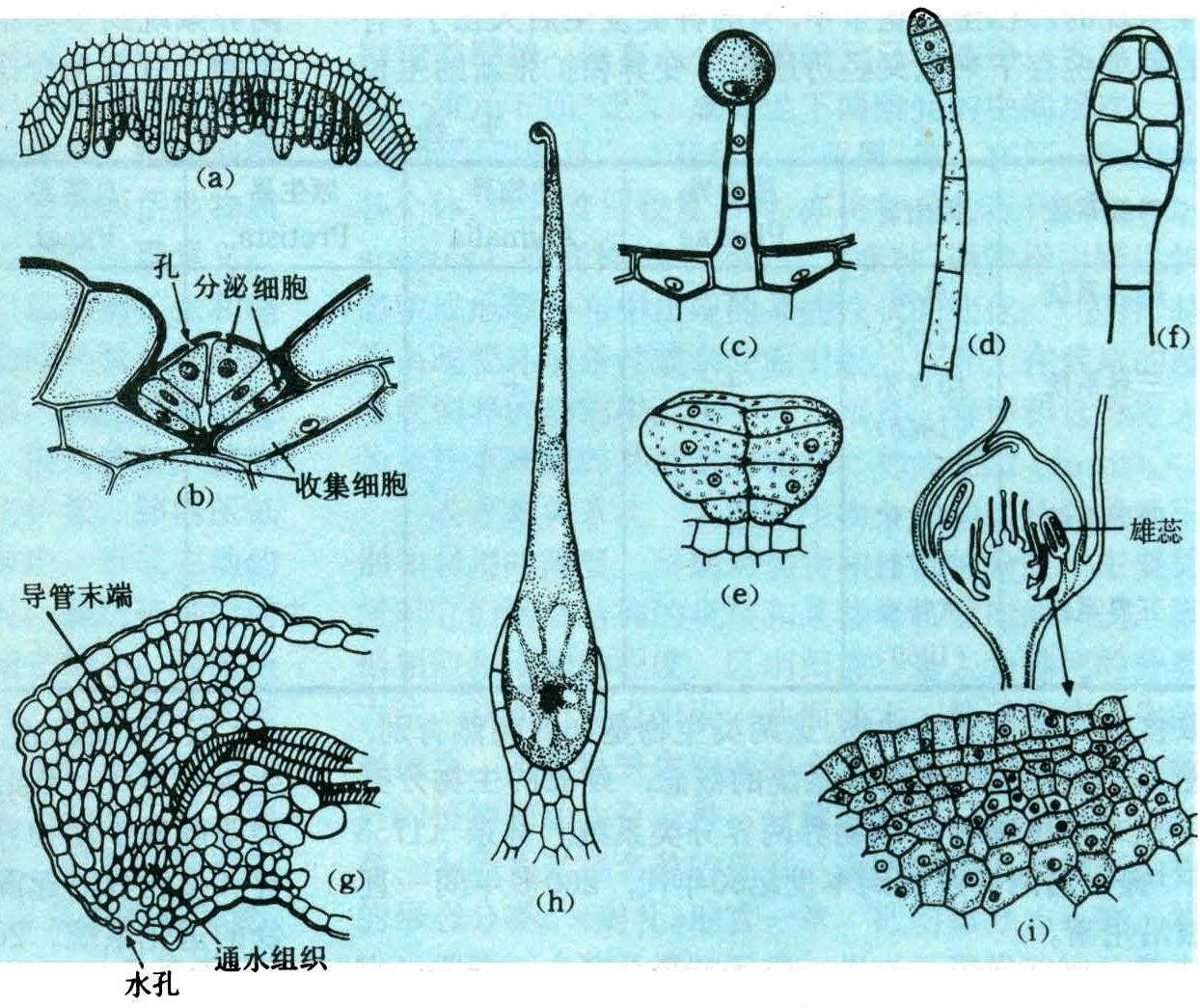 宫颈活检：腺鳞癌？【中美加宫颈病理交流群病例1409】 - 中美加宫颈病理学交流群 - 91360病理论坛