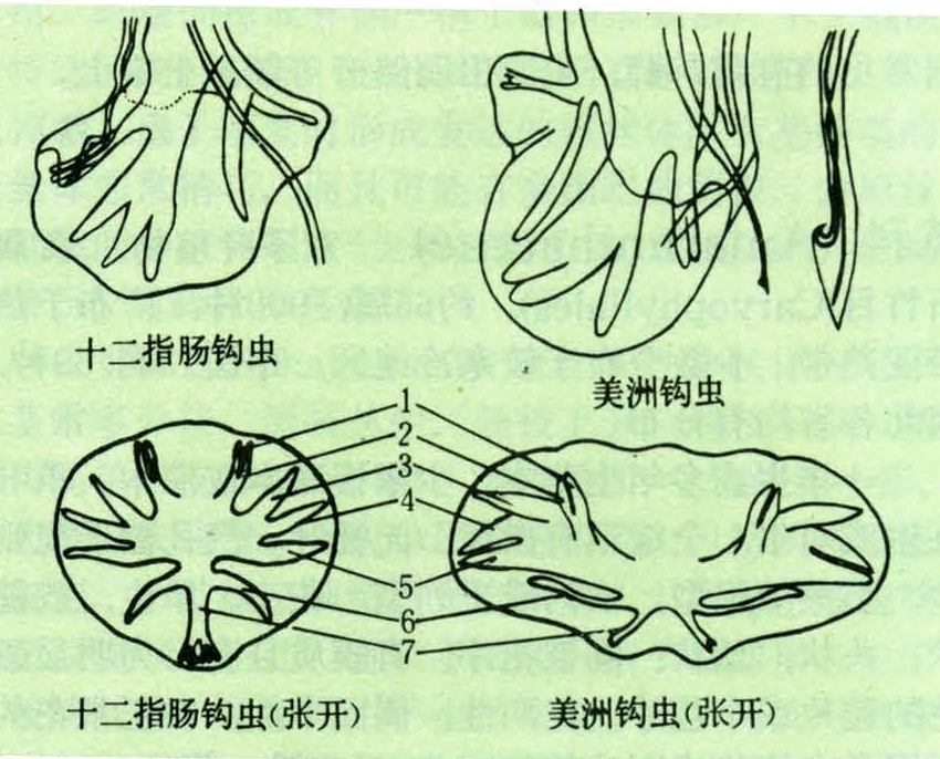 钩虫