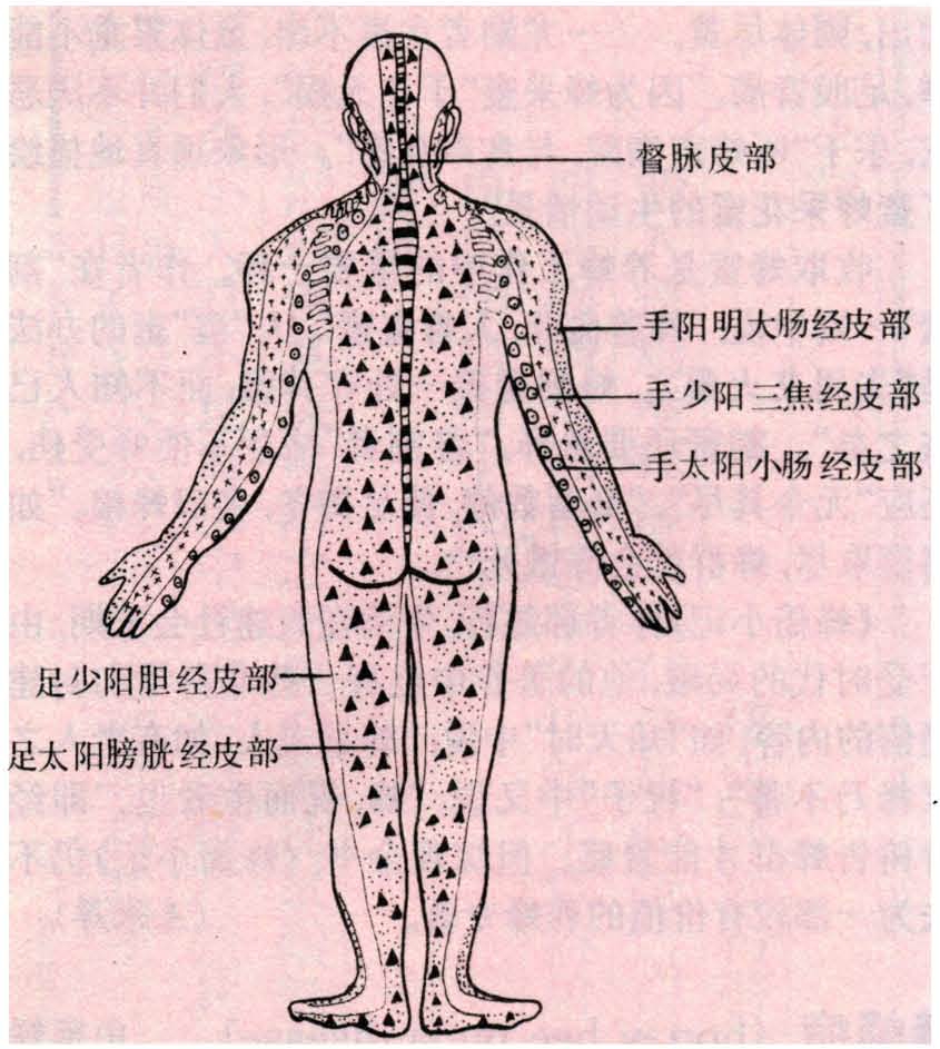 图2 十四经皮部分布示意图(背面)施行蜂针治疗时采取的针刺法主要有