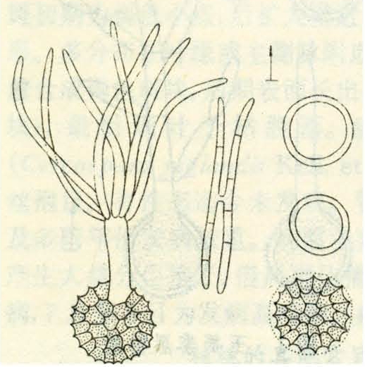 冬孢子堆多生于寄主子房,少数种寄生其它部位,粉状或带胶性,常有恶腥