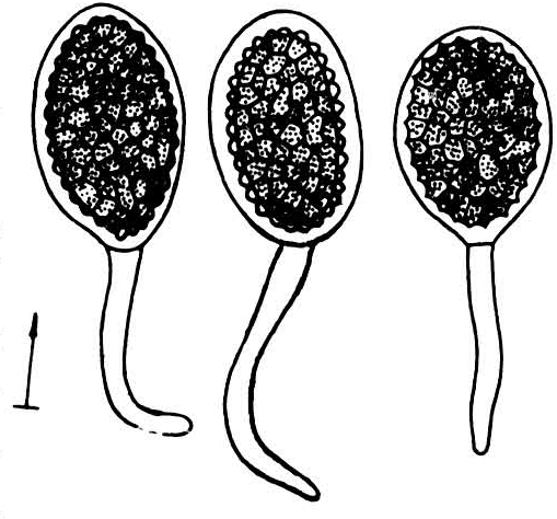 冬孢子堆多生于寄主子房,少数种寄生其它部位,粉状或带胶性,常有恶腥