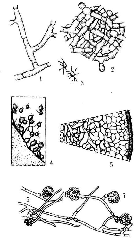 菌核褐色或黑色,表面粗糙,内外层颜色一致,结构较疏松.