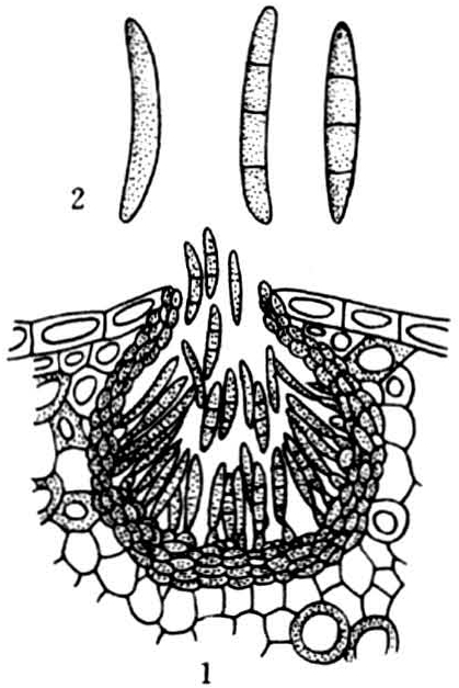 病原物为(phaeosphaeria nodorum e.muller,属子囊菌,格孢腔菌目.
