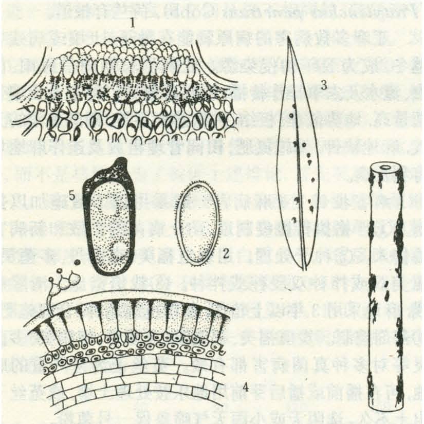 病原物为亚麻栅锈菌[melampsora lini(pers.)lév.],担子菌,锈菌目.